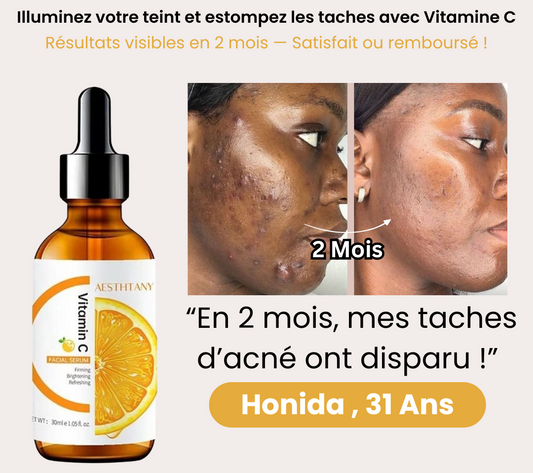 Aesthtany™ : illumine le teint et estompe les taches grâce à la vitamine C.