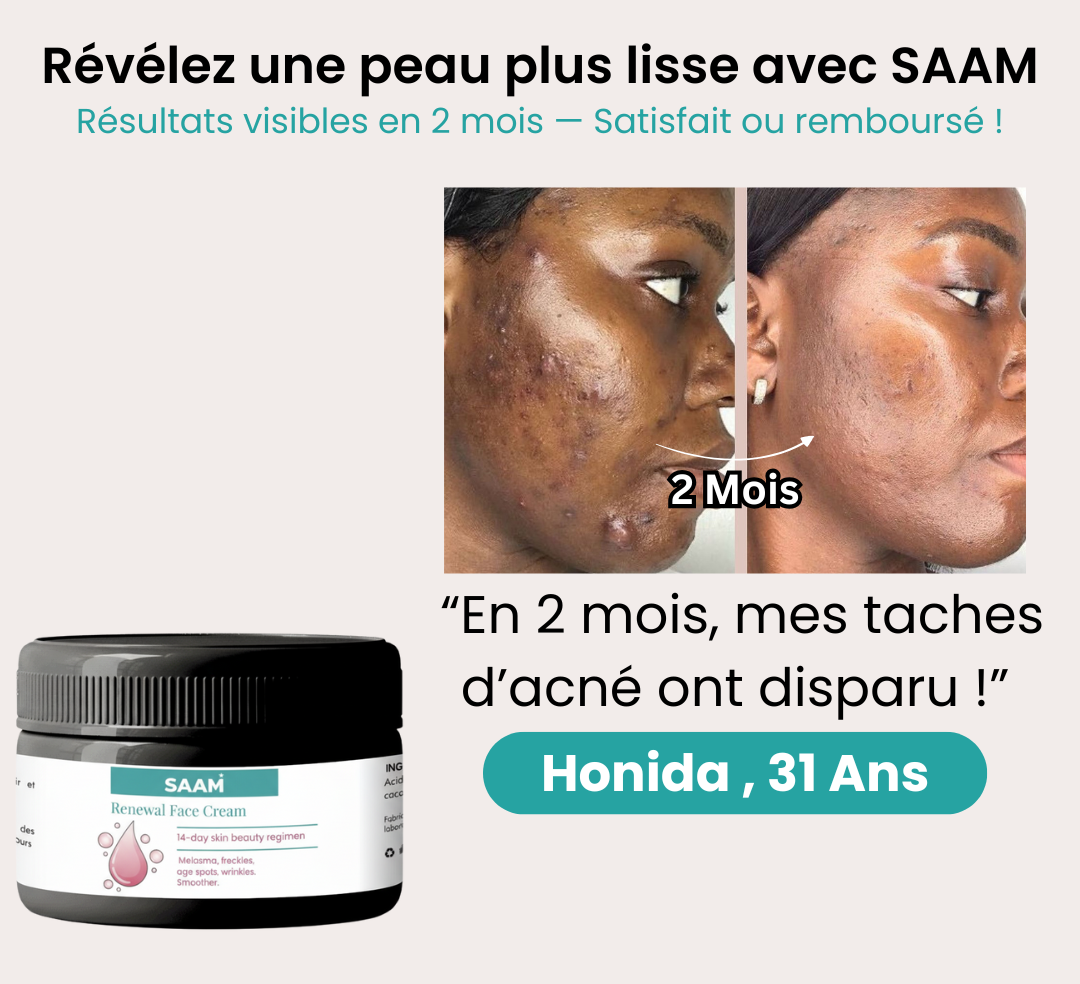 SAAM™ : tous les soucis de ta peau vont disparaître